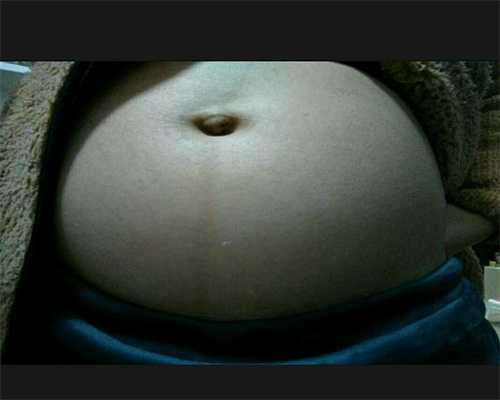 什么是输卵管性不孕-