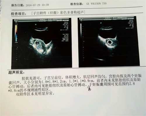 怀孕六个月孕妇被砍伤脱离休克胎儿仍需观察