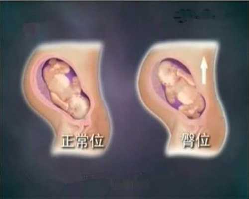 温州供卵包成功费用,广州私立医院做供卵试管婴儿一般花费15几万吗？