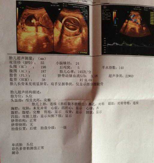 传好孕，二胎症状都是女宝，结果华丽翻盘顺产7斤6两男宝